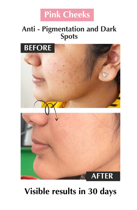 serum for pigmentation serum for pigmentation