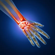 Best Hand Surgeon in Hyderabad – Dr Kartheek Telagareddy Best Hand Surgeon in Hyderabad – Dr Kartheek Telagareddy