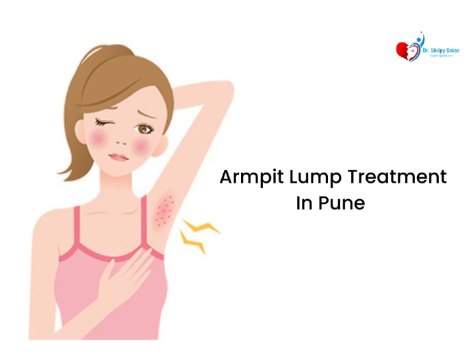 Dr. Shilpy Dolas offers effective armpit lump treatment in Pune, providing diagnosis and treatment for both benign and malignant lumps, ensuring optimal patient care. Dr. Shilpy Dolas offers effective armpit lump treatment in Pune, providing diagnosis and treatment for both benign and malignant lumps, ensuring optimal patient care.