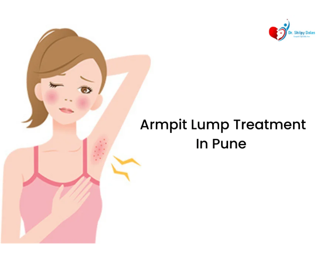 Dr. Shilpy Dolas is an expert in armpit lump treatment in Pune, providing personalized care for both benign and malignant lumps, ensuring safe and effective treatment options.