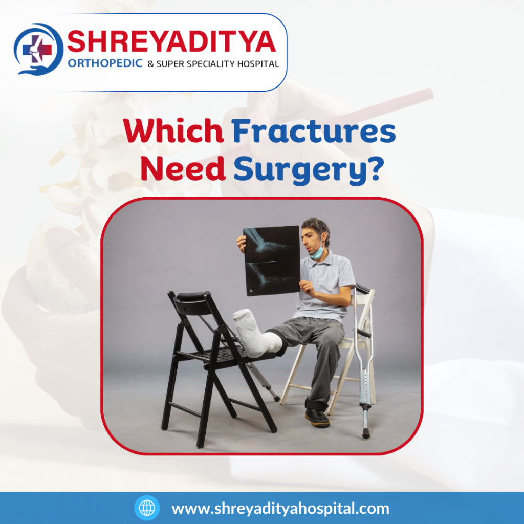 Which fractures need orthopedic surgery? Which fractures need orthopedic surgery?