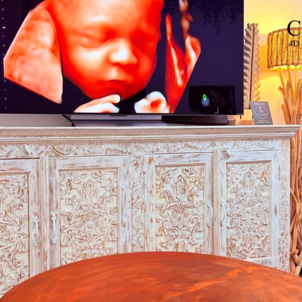 Cherish every moment with a 3D/4D ultrasound in Perth Cherish every moment with a 3D/4D ultrasound in Perth