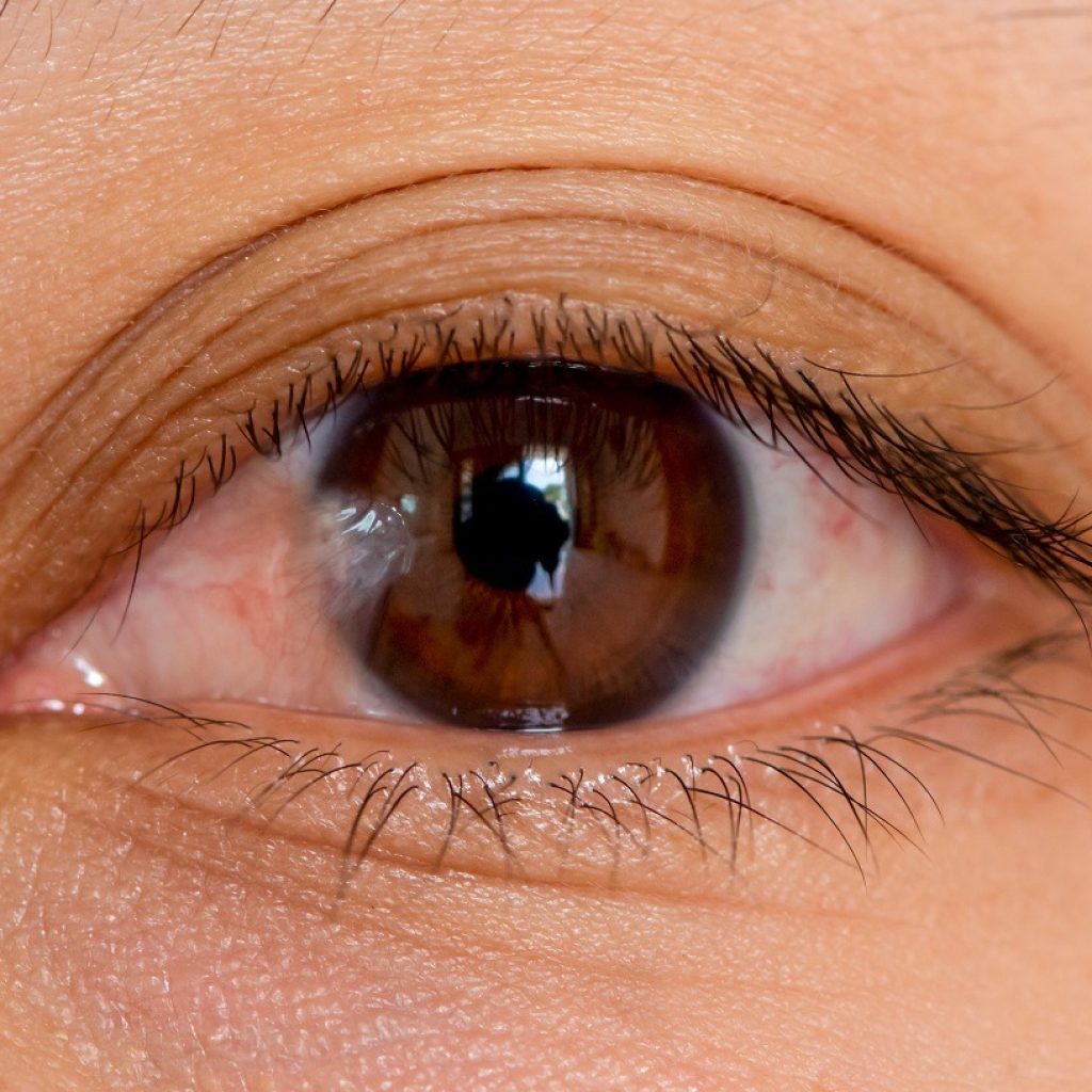 Top Local Treatments for Carnosidad: Find Expert Help Nearby Top Local Treatments for Carnosidad: Find Expert Help Nearby