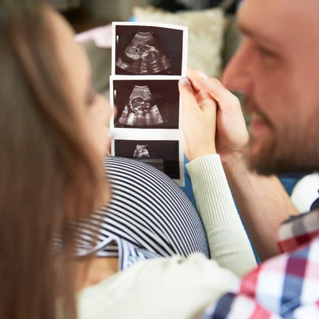 Prenatal Bonding Imaging in Perth: 3D/4D Ultrasound Experience