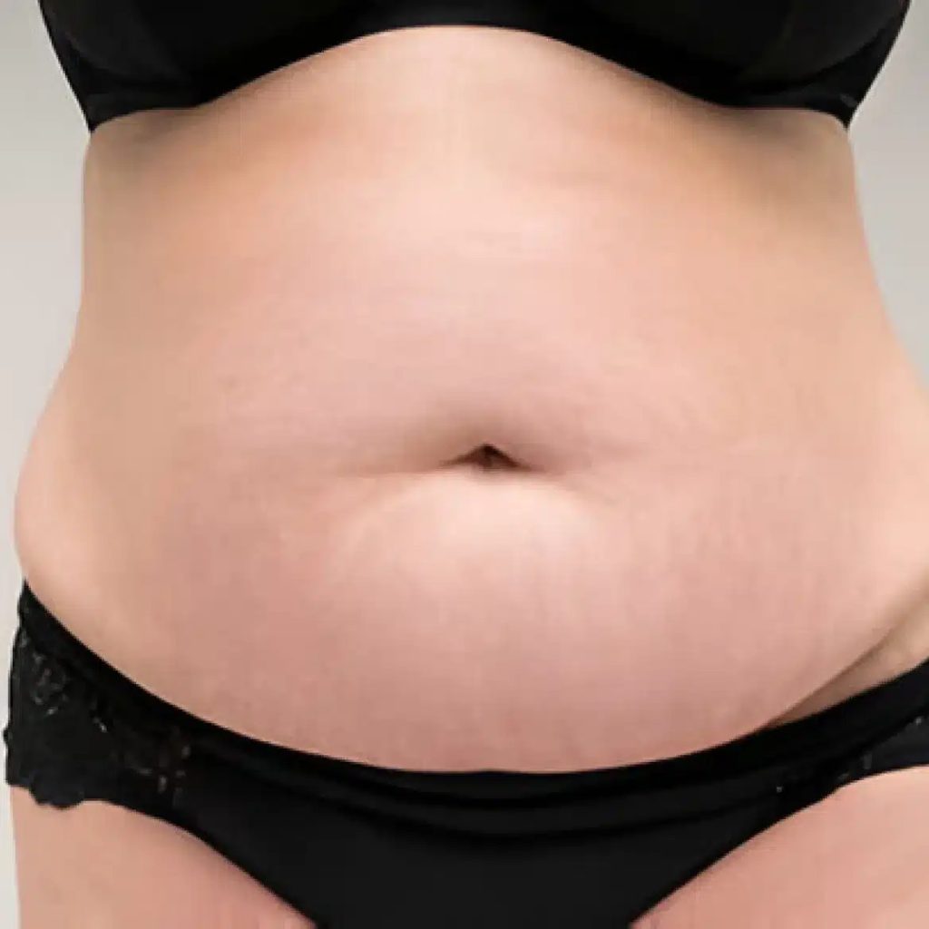 Dubai Scar Camouflage: Restore Confidence with Expert Skin Care