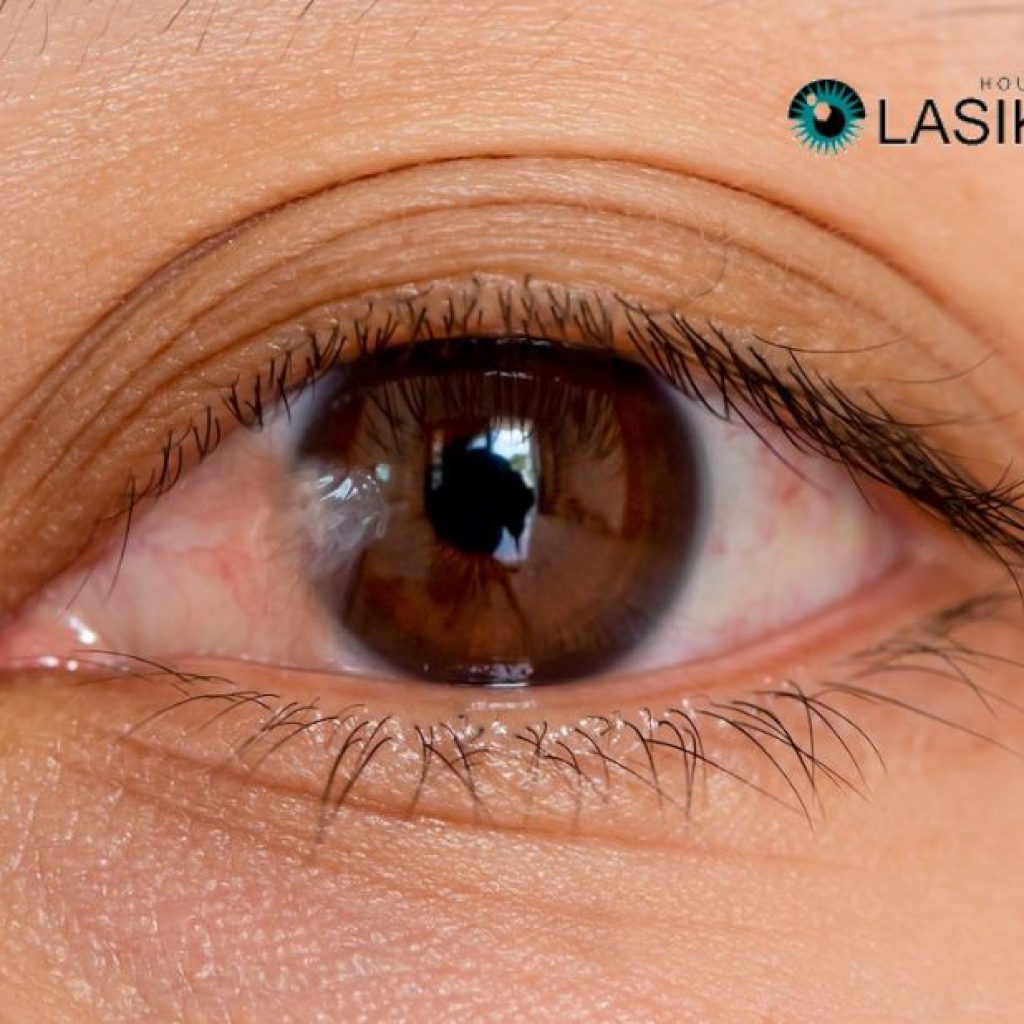Pterygium Treatment: Practical Ways to Protect Your Eyes