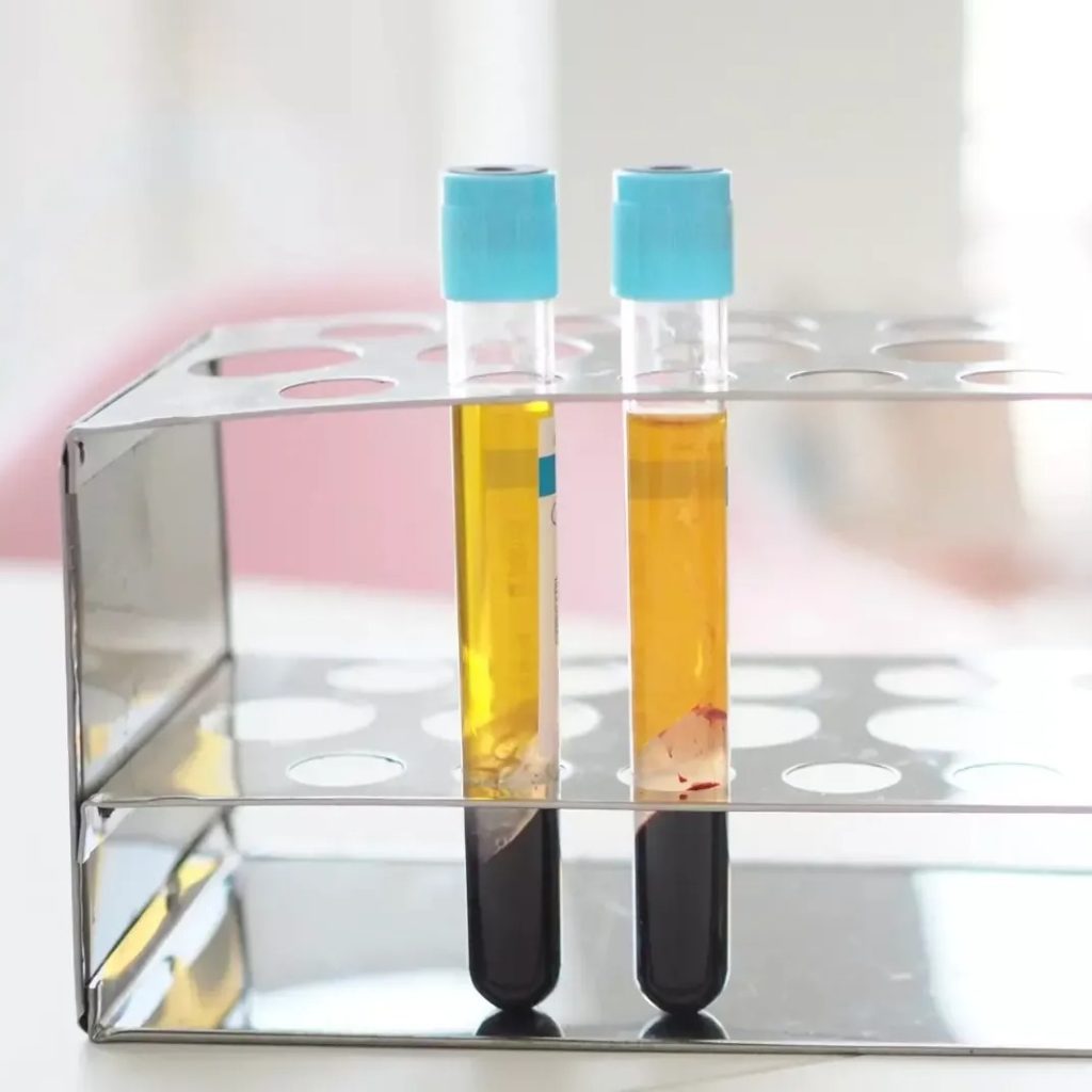 Aesthetic Skin Clinic In London | Thecheclinic.co.uk