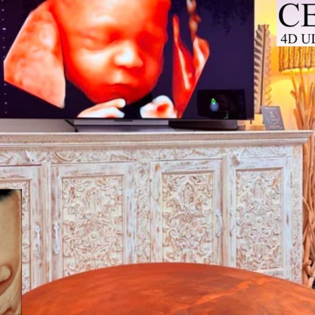 Discover Your Baby’s Surprise: 4D Scans in Perth