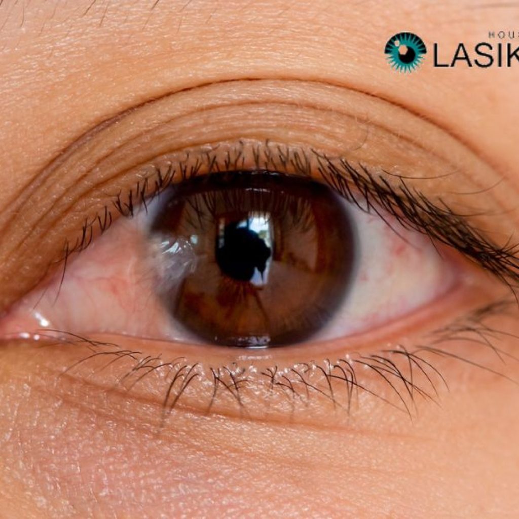 Understanding Options for Pterygium Removal Procedures