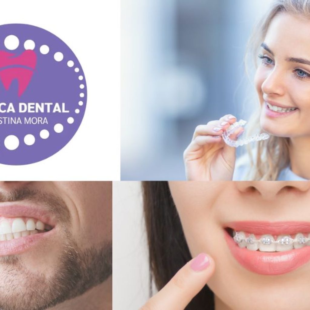Implants dentals a Gines: sols un somriure nou i saludable