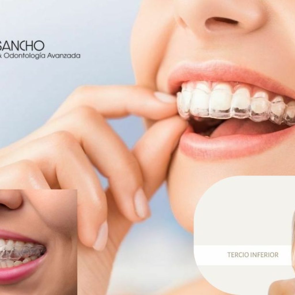 Sonrisa perfectapara ti: dentistas de confianza en Pozuelo