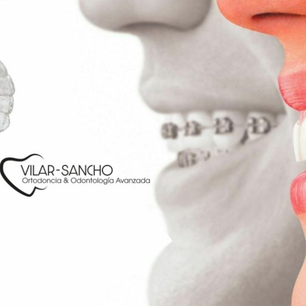 Sonrisa perfecta en Pozuelo: tu clínica dental de confianza
