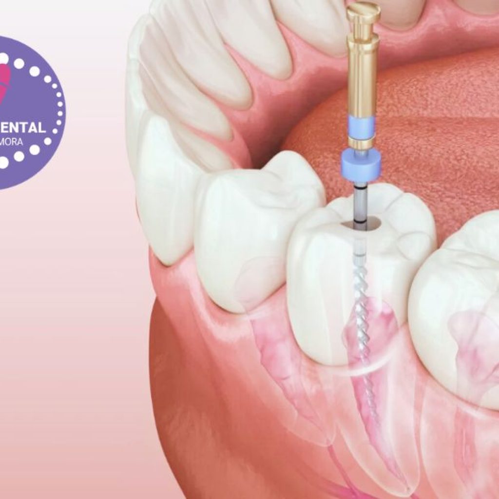 Odontologia de qualitat a Gines, serveis d’alta confiança