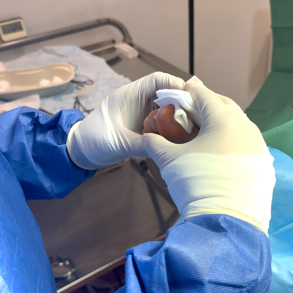 Relieve toe pain: effective care for nail edge discomfort Relieve toe pain: effective care for nail edge discomfort