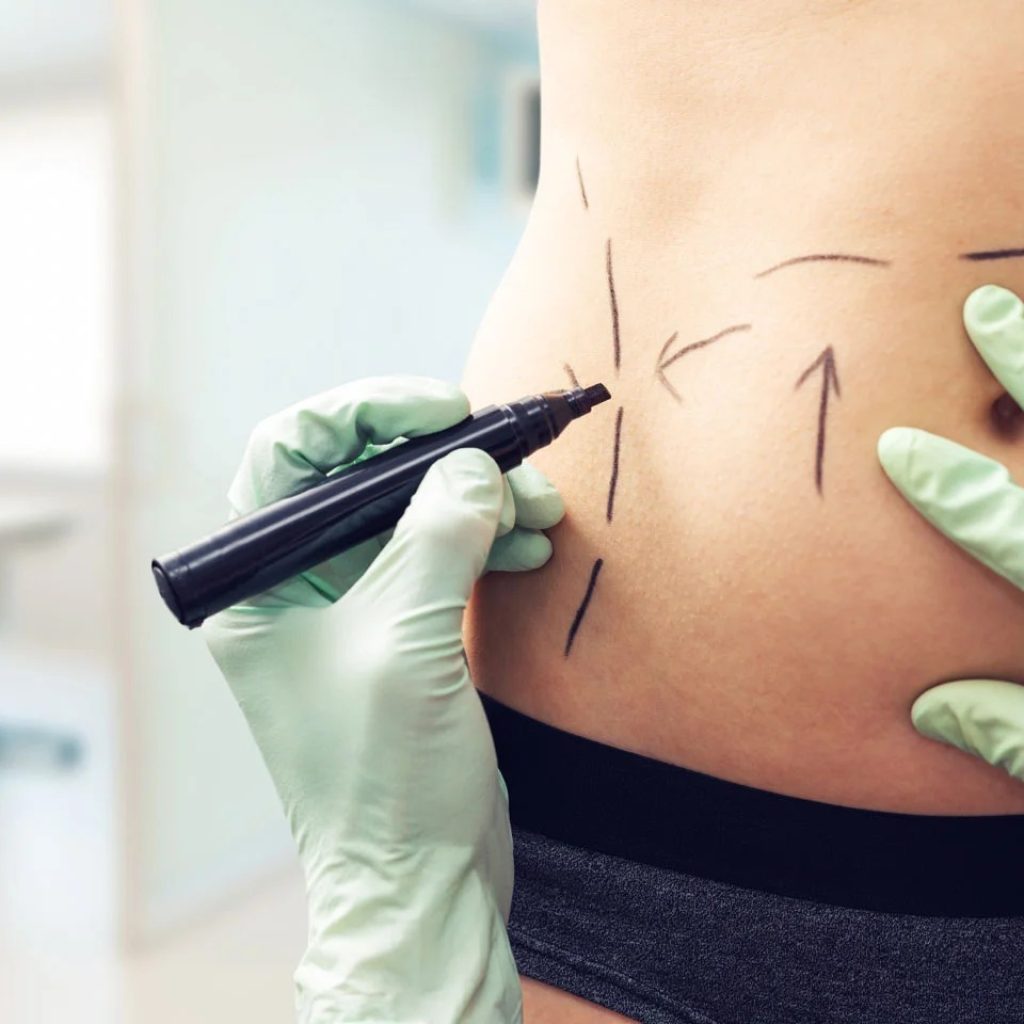 Lifted, natural contours: expert breast enhancement in Australia