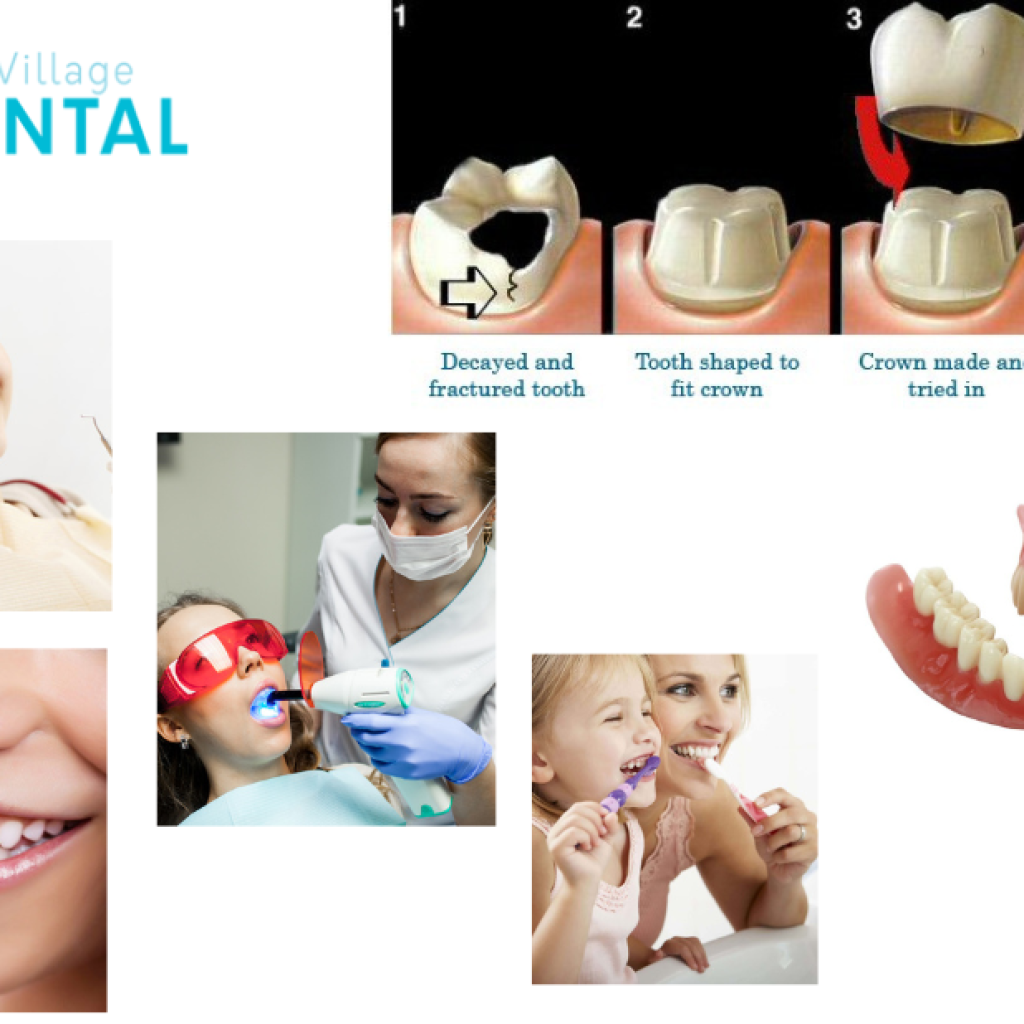 Preferred Professionals Corio Dentist For Reliable Dental Treatments