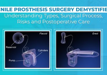 Penile Prosthesis Surgery   | Worldofurology