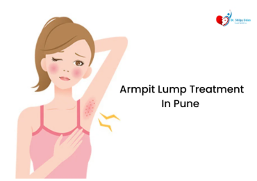 Dr. Shilpy Dolas offers effective armpit lump treatment in Pune, providing diagnosis and treatment for both benign and malignant lumps, ensuring optimal patient care.