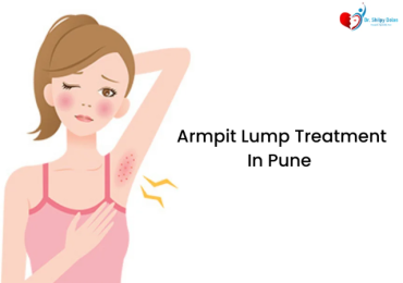 Dr. Shilpy Dolas is an expert in armpit lump treatment in Pune, providing personalized care for both benign and malignant lumps, ensuring safe and effective treatment options.