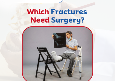 Which fractures need orthopedic surgery?